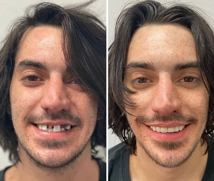 DentGrip™ | Un sourire solide, sûr et sans souci toute la journée - Science Factory FR
