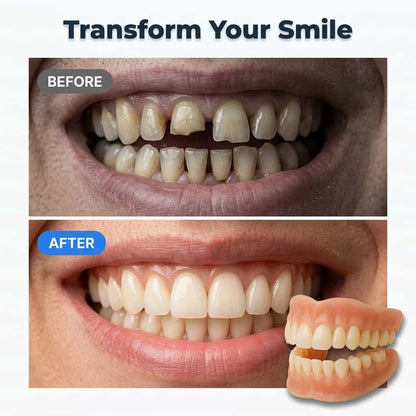 EasyFit Denture™ Ensemble de prothèses dentaires à ajustement personnalisé – Confort sans adhésif