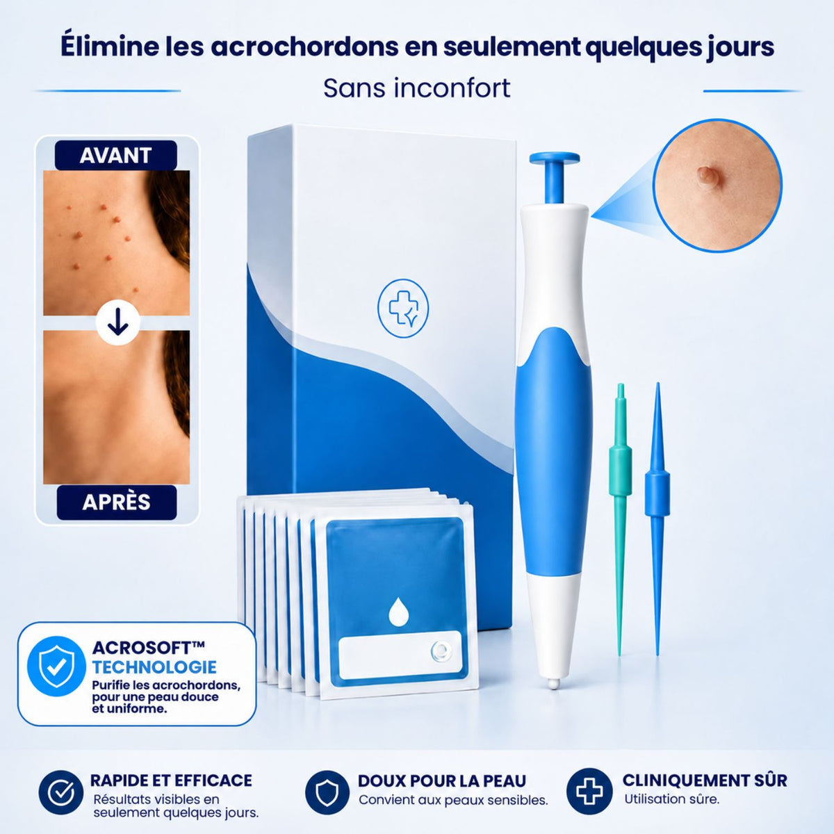 AcroSoft™ | Une peau lisse en seulement 4 jours