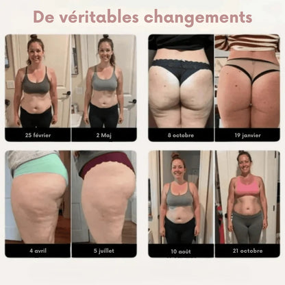 ActiveShape™ | Legging anti-cellulite à stimulation active