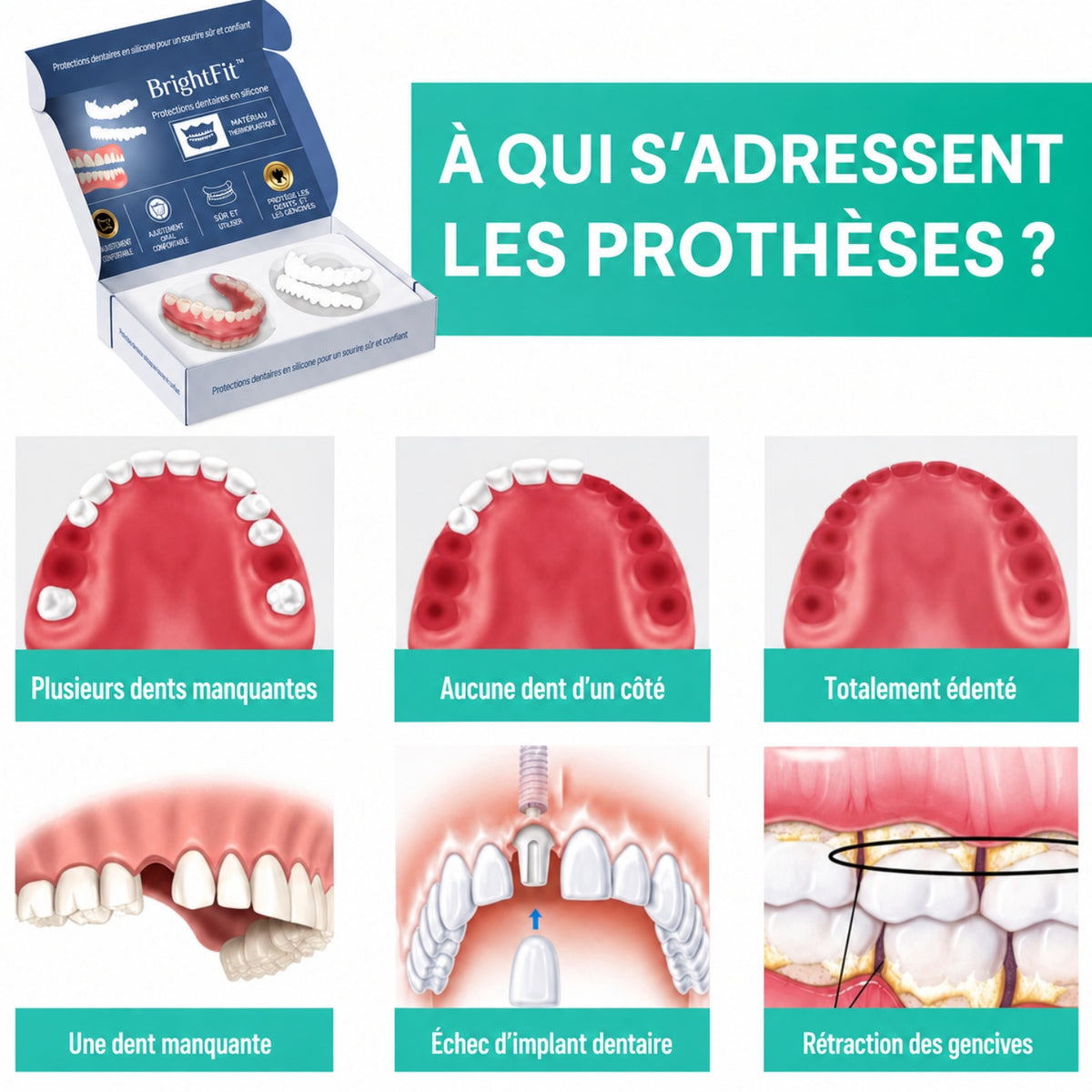BrightFit™ | Le sourire parfait et instantané, sans douleur ni rendez-vous