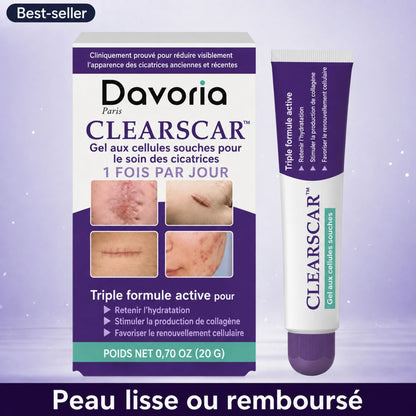 ClearScar™ | Rendez les cicatrices visibles plus lisses et moins apparentes