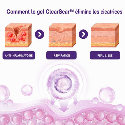 ClearScar™ | Rendez les cicatrices visibles plus lisses et moins apparentes