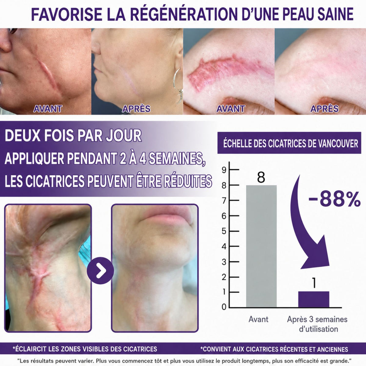 ClearScar™ | Rendez les cicatrices visibles plus lisses et moins apparentes