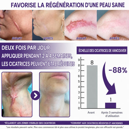 ClearScar™ | Rendez les cicatrices visibles plus lisses et moins apparentes