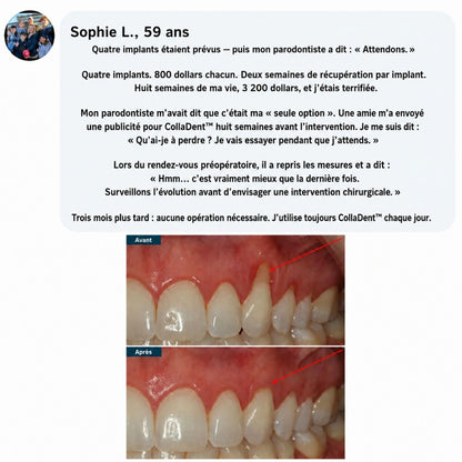 CollaDent™ | Renforcez vos gencives de l’intérieur et préservez votre sourire naturel
