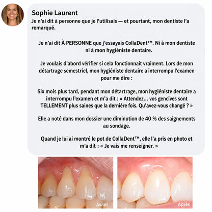 CollaDent™ | Renforcez vos gencives de l’intérieur et préservez votre sourire naturel