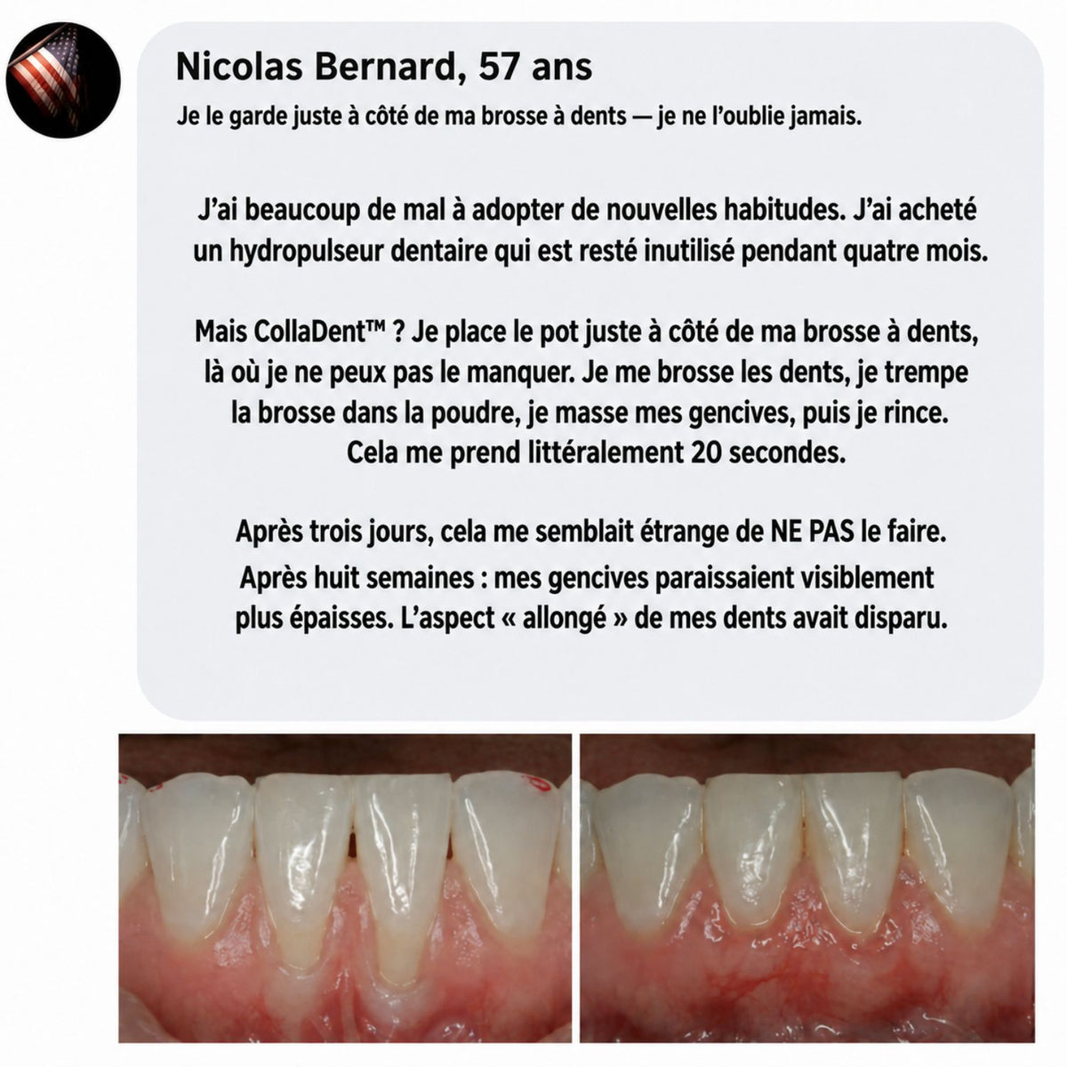 CollaDent™ | Renforcez vos gencives de l’intérieur et préservez votre sourire naturel