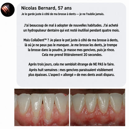 CollaDent™ | Renforcez vos gencives de l’intérieur et préservez votre sourire naturel