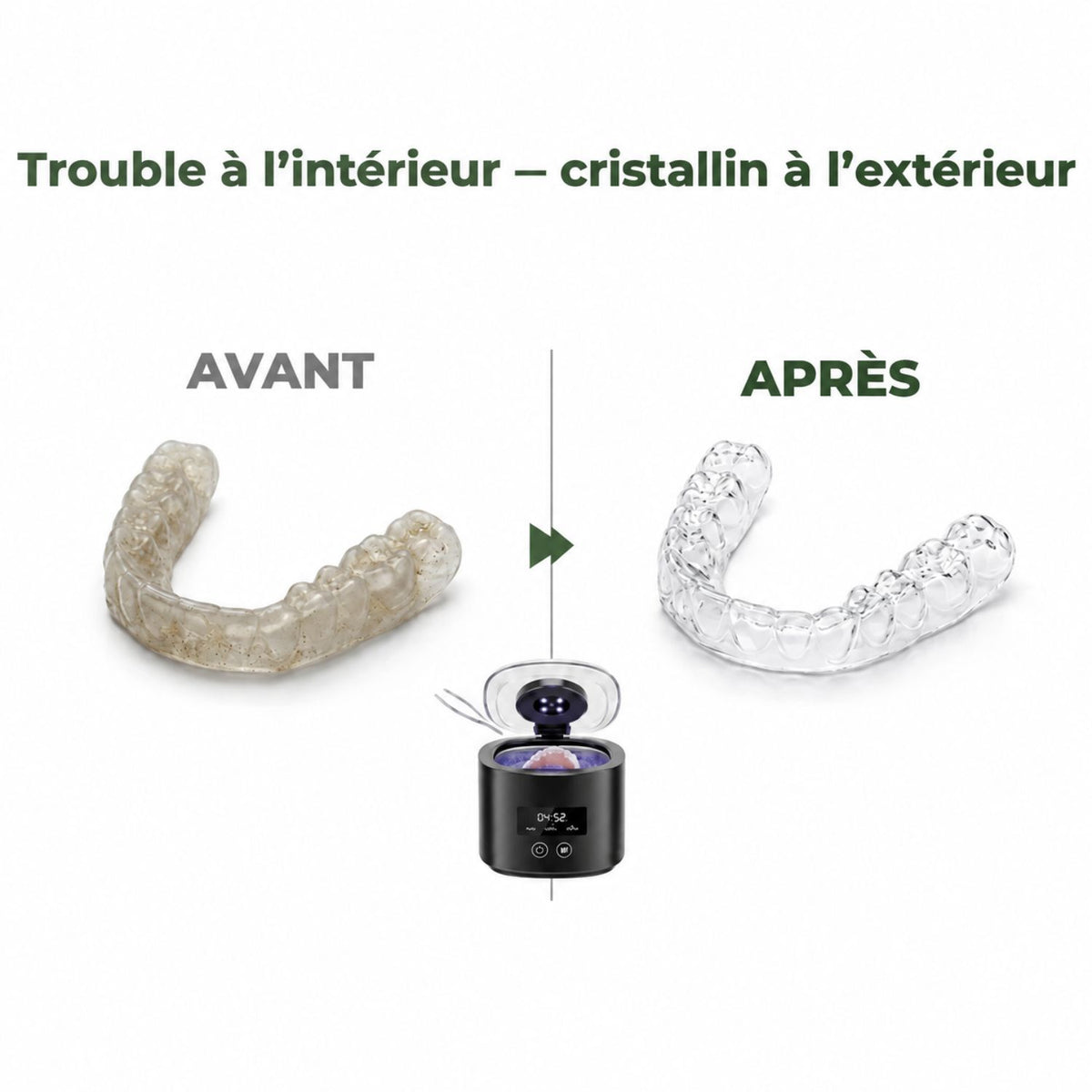 UltraClean™ | Nettoyage en profondeur de votre gouttière dentaire en seulement 5 minutes